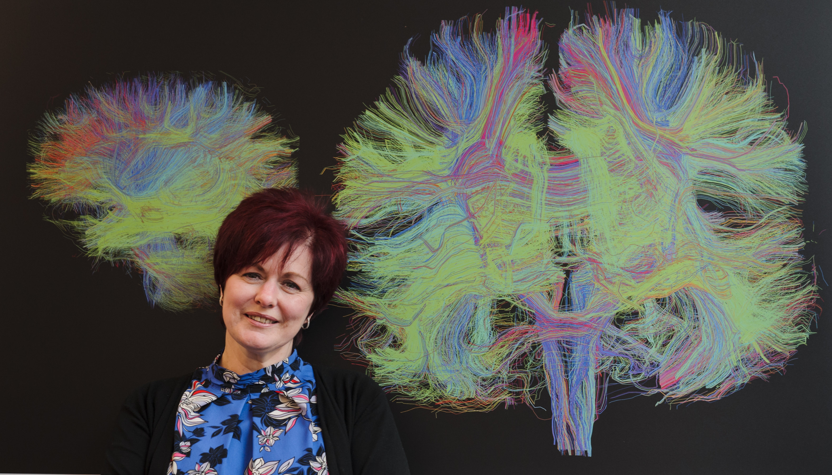 Julie Duffus stands in front of a colourful MRI image of the brain